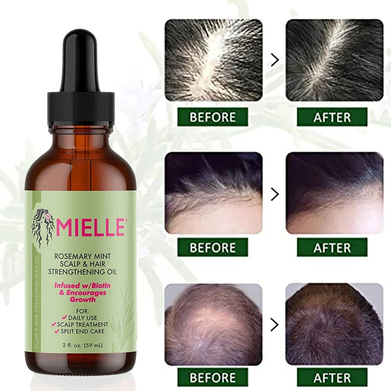 Natural Rosemary Hair Growth & Thickening Oil (Therapeutic Anti-Hair Loss Formula)