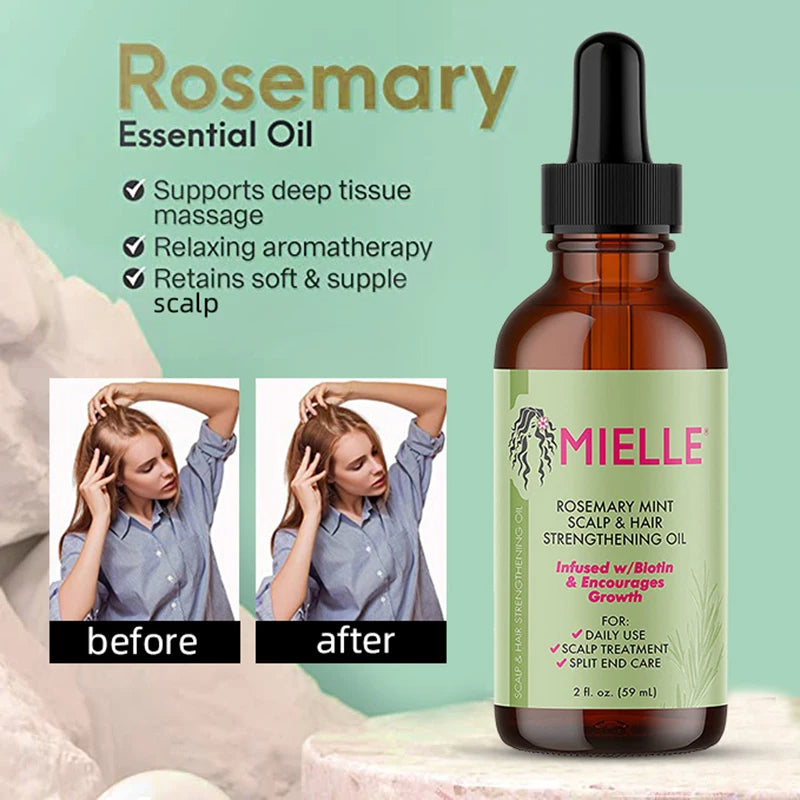 Natural Rosemary Hair Growth & Thickening Oil (Therapeutic Anti-Hair Loss Formula)